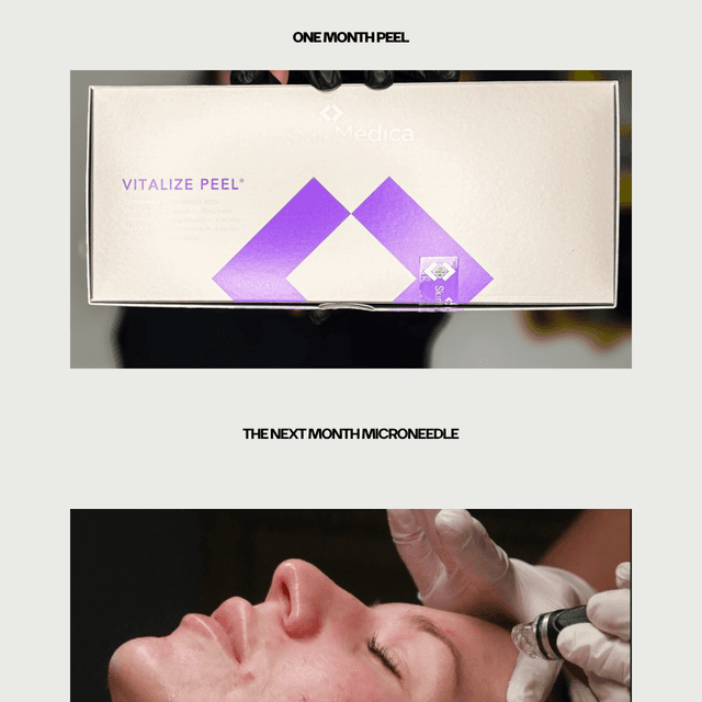 Peel + Microneedling Bundle at Mirror Mirror Aesthetics in Dunkirk, IN